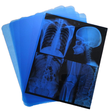 Film a raggi X medici a bassa nebbia con risoluzione 320dpi 14 x 17 su Led X Ray Film View Box