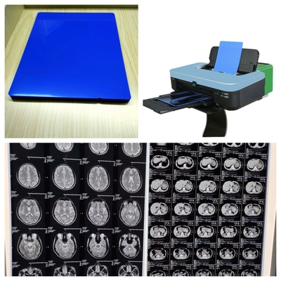 Pellicola a getto d'inchiostro a raggi X lucida Blu Bianco Con Risoluzione 9600x2400dpi Durabilità duratura