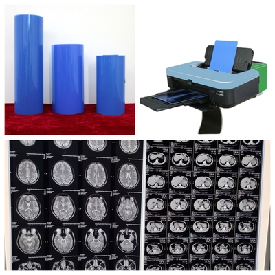 Alta Durabilità Filtro a getto d'inchiostro Blu Medicale a raggi X Stabilizzazione dell'immagine blu duratura