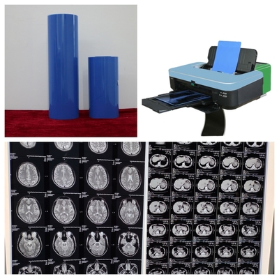210 micron Blue Base Inkjet Printing X Ray Film Con Risoluzione 9600x2400dpi Per A3+ CR DR