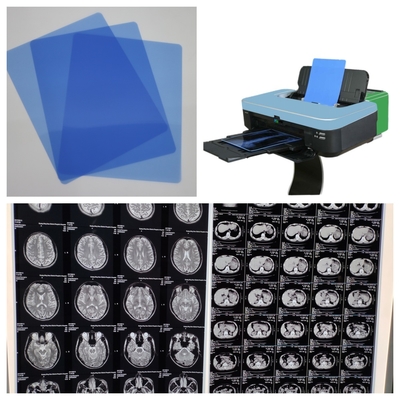 210 micron Blue Inkjet X Ray Film MRI Image Output con alta qualità di stampa per bianco nero