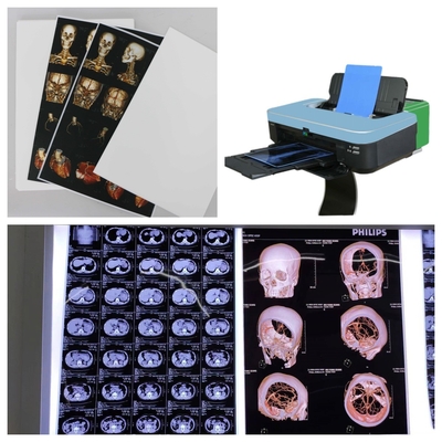 9600x2400dpi Film a getto d'inchiostro a raggi X PET blu trasparente per immagini mediche ad alta risoluzione