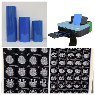 Film a getto d'inchiostro medico a base di PET blu con elevata stabilità dell'immagine con elevata risoluzione