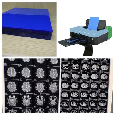 210 micron PET Inkjet X Ray Film 14 pollici con alta stabilità dell'immagine