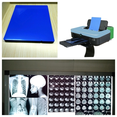 Fogli di pellicola a raggi X a getto d'inchiostro 8x10 10x12 11x14 14x17 A4 A3 A3+ 13X17 Con velocità di stampa 1-3 minuti