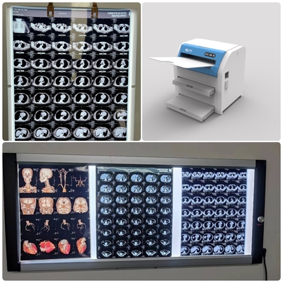11x14 14x17 pellicola di Fuji secca medica con densità di trasmissione massima ≥ 3,0 D