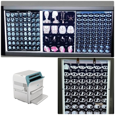 Film a raggi X medici a bassa nebbia con risoluzione 320dpi 14 x 17 su Led X Ray Film View Box