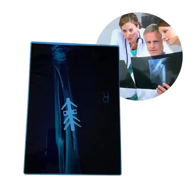 Stampa a secco termica medica CT Stampa a getto d'inchiostro Film blu A4 PET attrezzature mediche ortopediche Film a raggi X