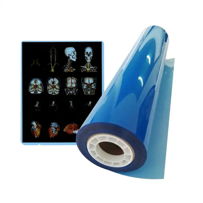 Stampa a secco termica medica CT Stampa a getto d'inchiostro Film blu A4 PET attrezzature mediche ortopediche Film a raggi X