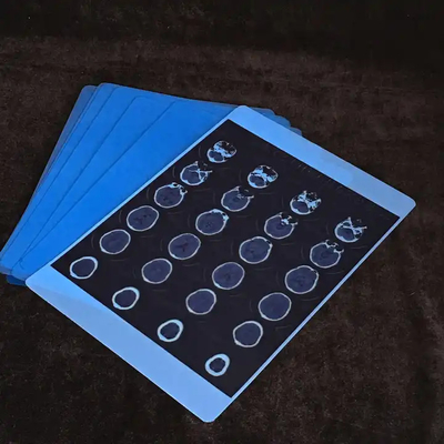 Film a raggi X blu avanzato per l' imaging chiaro e preciso
