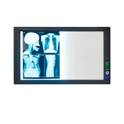 Film termico secco per radiografia medica per stampante