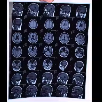 Film termico secco per radiografia medica per stampante