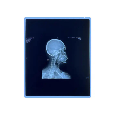 Film asciutto per raggi X medici Film a getto d'inchiostro per raggi X medici con qualità di immagine chiara