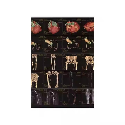 Film termico secco per radiografia medica per stampante