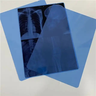 Improntabile a getto d'inchiostro con PET Laser asciutto a raggi X Film trasparente base blu per l'imaging diagnostico