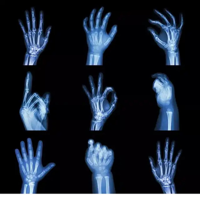 Film a raggi X asciutto laser compatibile con stampante laser Fuji Drypix 4000 6000 7000 stampante laser medica