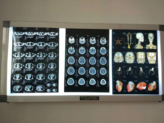 Imaging a pellicola secca a raggi X impermeabile per dispositivi medici