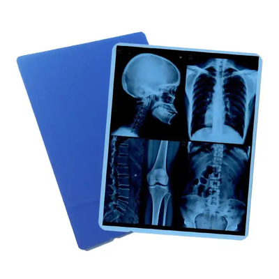 Sistema di immagine medica Film asciutto laser a raggi X per DR CR MRI - stampante a raggi X con ISO CE