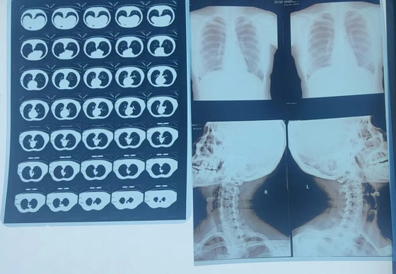 Sistema di immagine medica Film asciutto laser a raggi X per DR CR MRI - stampante a raggi X con ISO CE