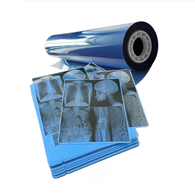 Tintura a pellicola medica blu per risultati coerenti di imaging a raggi X