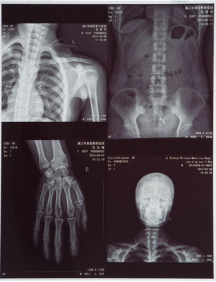 Color blu 10X12 Inch Inkjet Animal Medical X-ray Film/Image