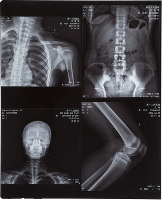 Color blu 10X12 Inch Inkjet Animal Medical X-ray Film/Image