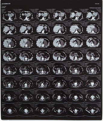 Film per raggi X medici ad alta lucidità FUJI DIHT 14*17in Laser Dry Imaging Film