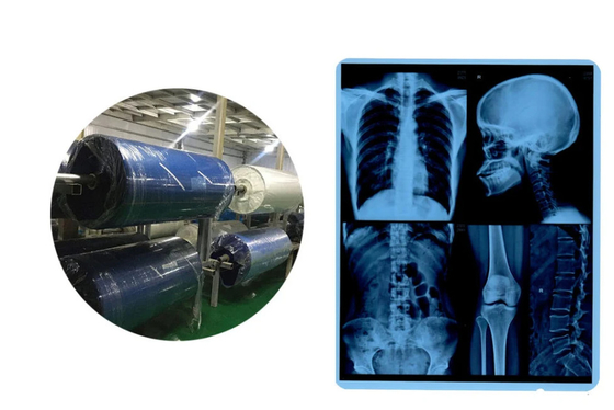 Rulli di pellicola a raggi X medici a getto d'inchiostro Base blu per la CR DR CT uscita di immagine MRI
