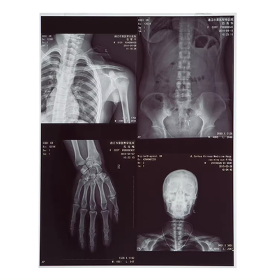 210 micron Film a raggi X Laser a getto d' inchiostro medico per TAC