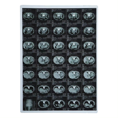 210 micron Film a raggi X Laser a getto d' inchiostro medico per TAC