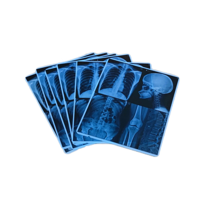 Alta stabilità dell'immagine Blu Film Medico Inkjet Per Inkjet Film a raggi X