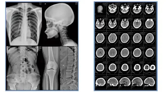 Pellicola radiologica medica pellicola termica secca per immagini chiare