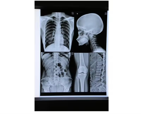 Blue Inkjet Medical X Ray Film Medical Dry Film A4 Sheet Or In Roll Nessuna recensione ancora