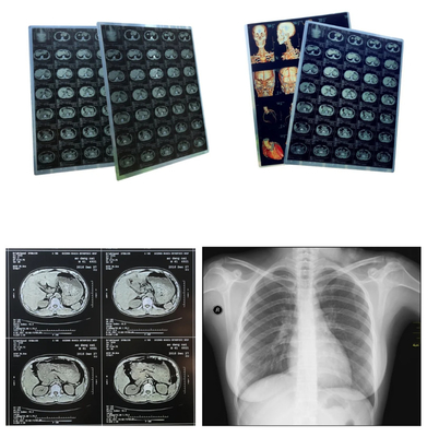 Filtro a raggi X blu a getto d'inchiostro Medicale Filtro a secco Immagine chiara