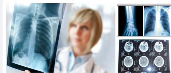Film a raggi X in bianco e blu per immagini diagnostiche accurate