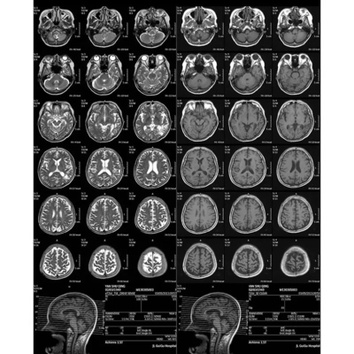 Film radiografico medico monouso regolato per densità automatica
