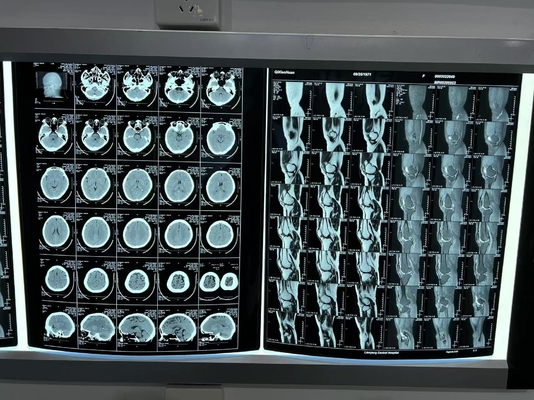 Film di stampa termica a raggi X a laser blu per l'imaging radiologico singolo
