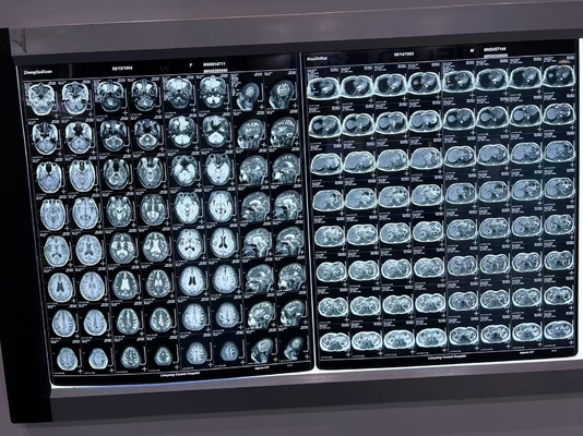 Film a raggi X di densità automatica per apparecchiature mediche
