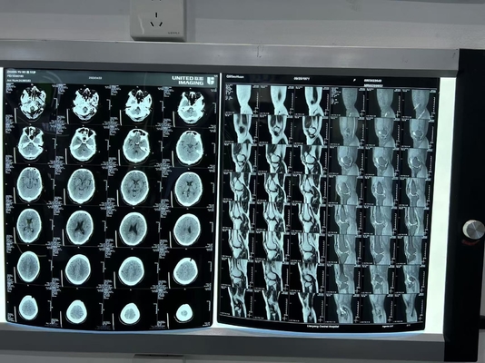 Film a raggi X laser diagnostico a densità aumentata 0.28D per apparecchiature mediche