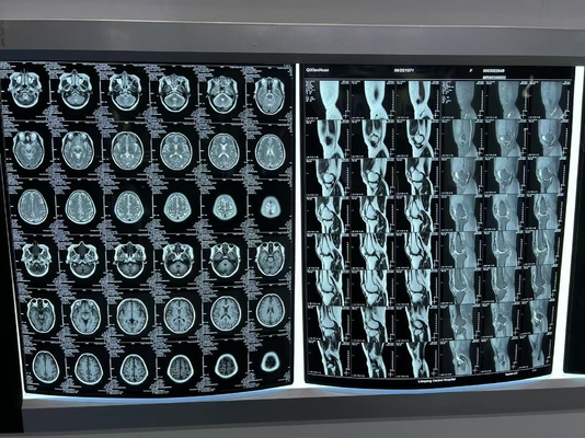 Film a raggi X a stampa termica blu per diagnosi accurata