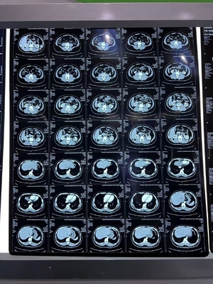 Apparecchiature mediche Pellicola di stampa termica laser a raggi X a densità blu
