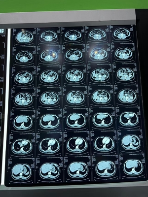 Film di stampa termica per apparecchiature mediche a raggi X