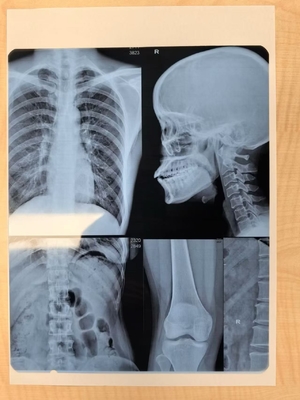 Regolazione automatica della densità del film laser a raggi X per l'imaging medico