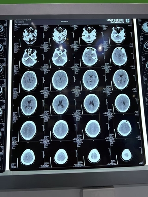 3.0D Contrasto Flessibilità superiore Film a raggi X laser asciutto per uso medico