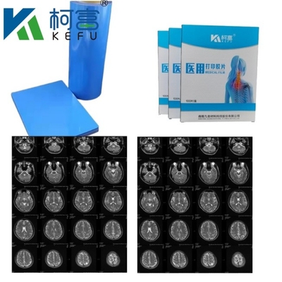 Immagine medica CT DR Tinta a getto Blu Film Medicale Raggi X PET Film A4