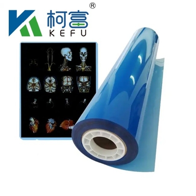 Film radiografico medico di fabbrica Blu Film radiografico medico sensibile