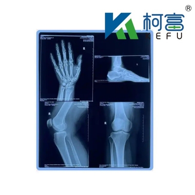 Film radiografico medico di fabbrica Blu Film radiografico medico sensibile