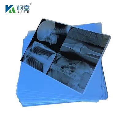 A4 inchiostro medico Jet Blue Film X-Ray PET Film X-Ray Paper