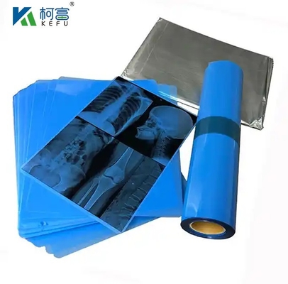 Immagini mediche a base di PET blu con film termico/inkjet a raggi X per cliniche e ospedali