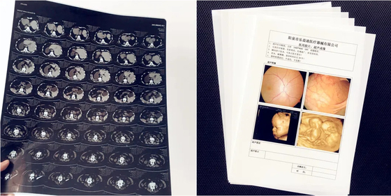 Prodotti medici Film di stampa laser Bianco opaco Film medico a raggi X Film di stampa d'immagine Per stampante a getto d'inchiostro Epson &amp; Canon